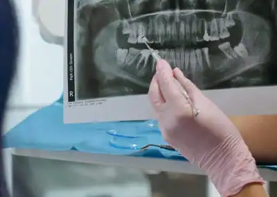 Dental X-ray with examination tools