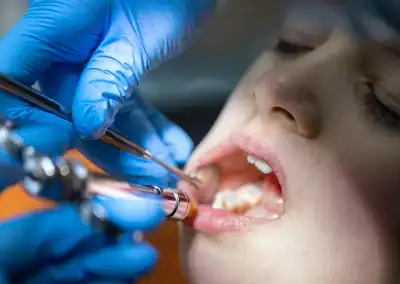 Dental procedure on a patient