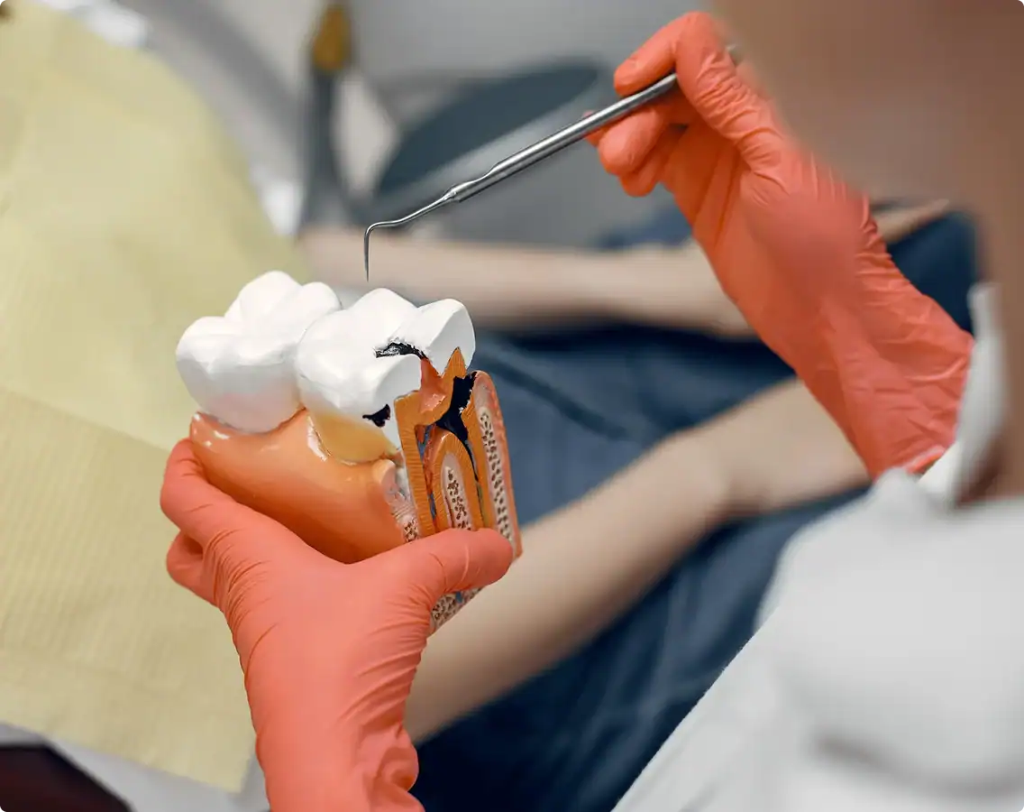 Dental model with root canal demonstration