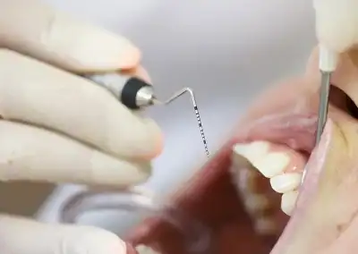 Dental examination with tools in mouth