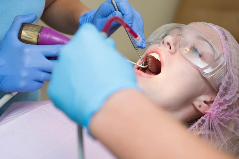 Deep cleaning (Scale & Root Debridement)