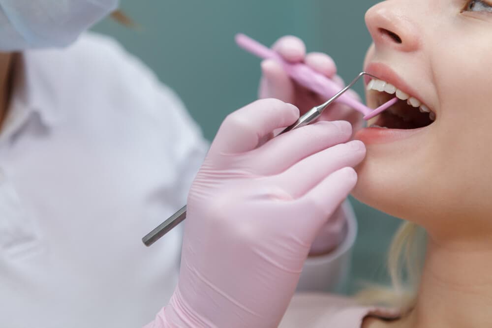 Maintenance After Veneers Maintenance After Veneers