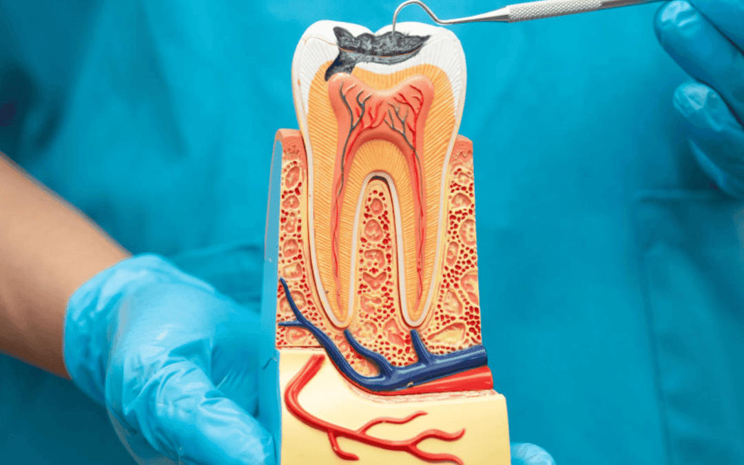 Root Canal Therapy in Prahran: What to Expect and Why It Saves Teeth