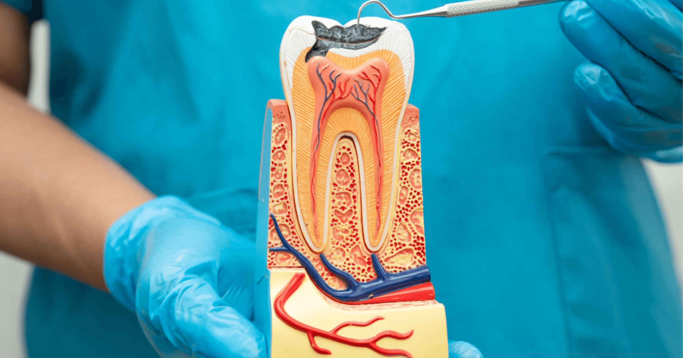 Root canal therapy Prahran