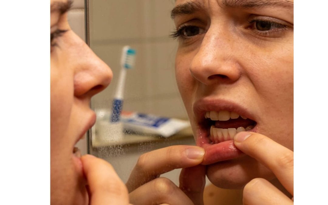 What Causes Bleeding Gums — and When Should You Worry?
