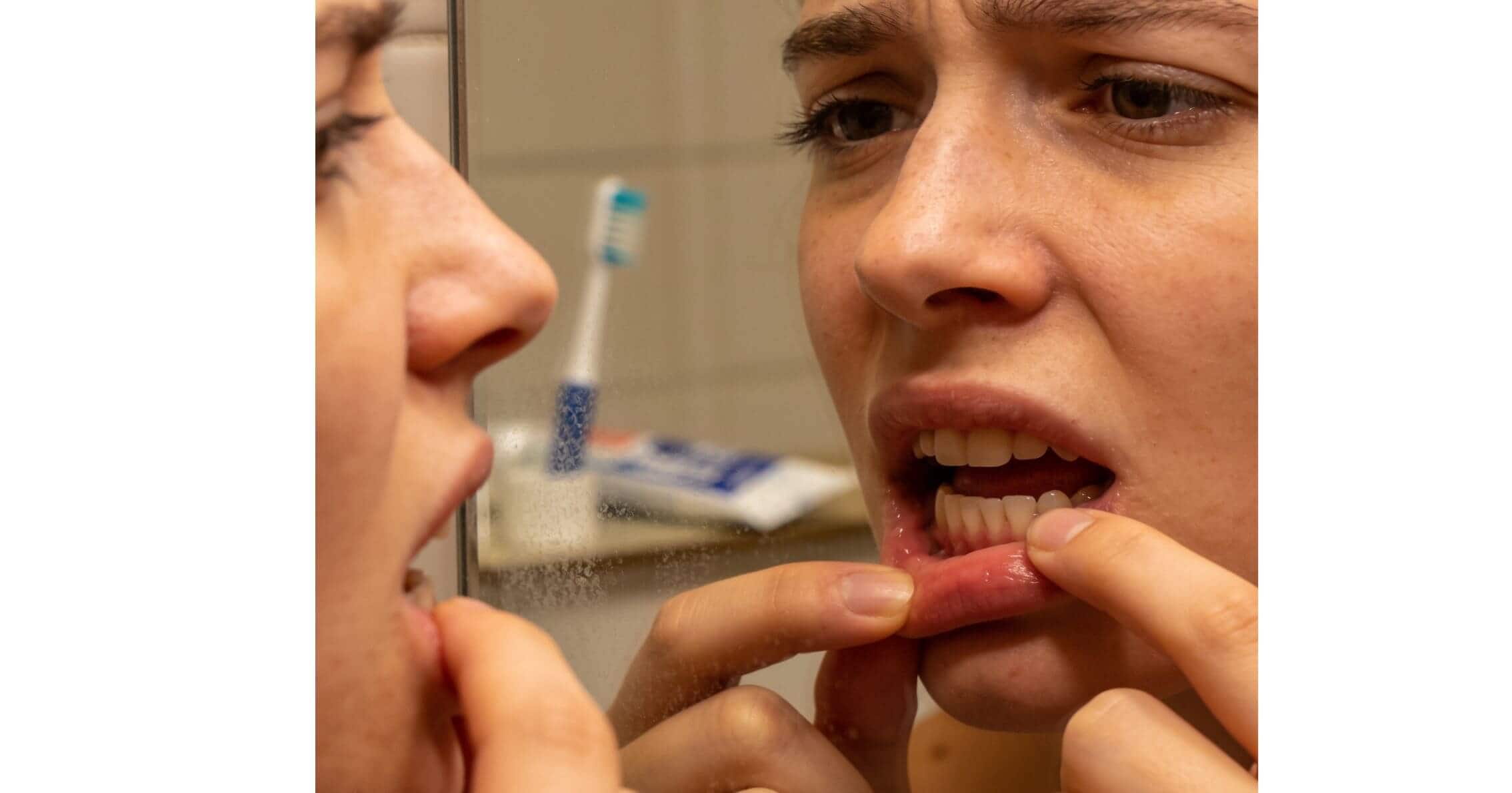 Person checking bleeding gums in mirror at home in Prahran